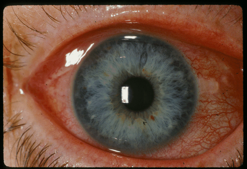 Case 395 photo 2, clinical photo 2