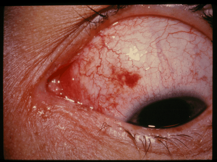 Case 396 photo 1, clinical photo 1